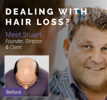 Superior Hair Extension Mens Hair Loss Solutions