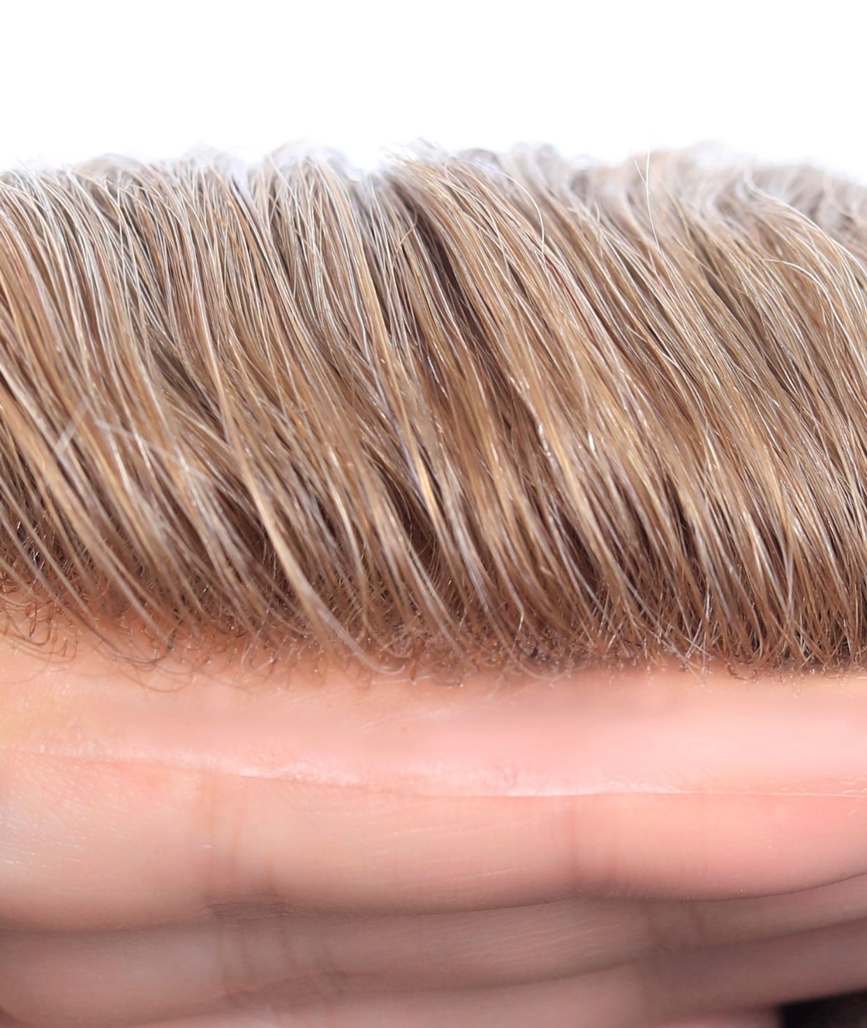 #20  Skin Base Hair System