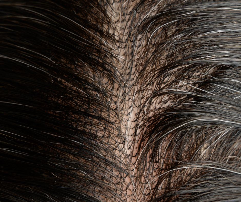 #1B Off Black Lace Front Hair System