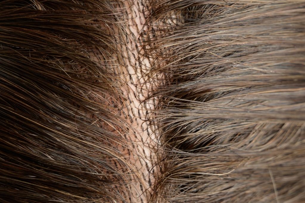 #4 Medium Brown Skin Base Hair System